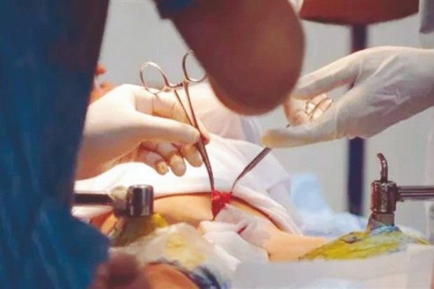 Circoncision collective à Constantine : Les mises en garde des services de la santé