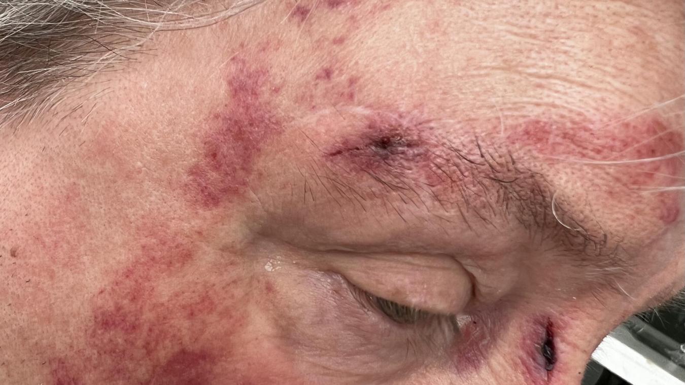 BATNA : Un homme sauvagement agressé à son domicile