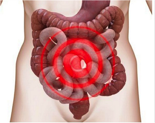 Syndrome de l’intestin irritable : Une histoire de neurones !