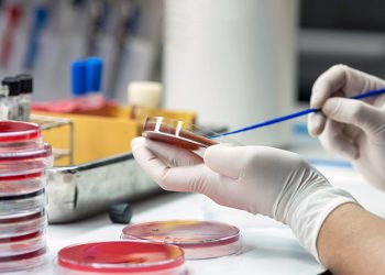 Suite à des analyses microbiologiques : Découverte de bactéries chez des pâtissiers à Constantine