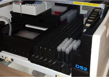 Le CHU se dote de technologies de pointe : Introduction des tests «ELISA»