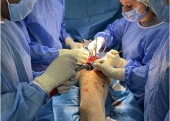 CHU Ibn Rochd : 14 chirurgies complexes de la hanche réalisées avec succès