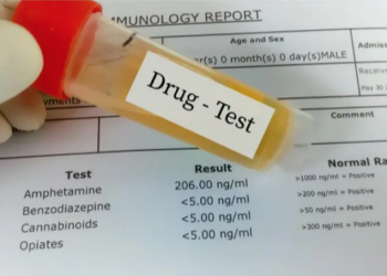 Tests de dépistages des dossiers de recrutement  : Le texte d’application pas encore prêt !  